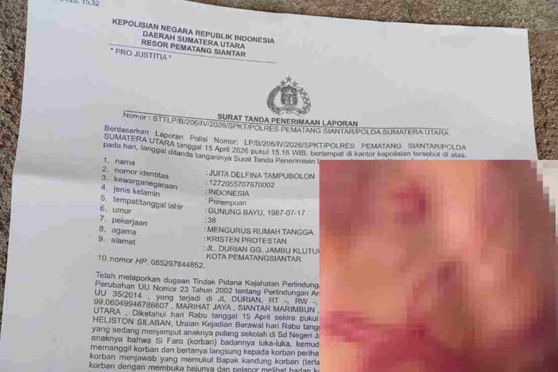 Laporan Polisi dan bekas lebam pada tubuh siswa