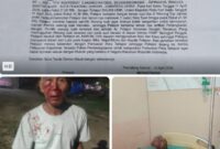 Warga Kota Pematangsiantar bernama Irwansyah Daulay (59), warga Lapangan Bola Bawah, Kecamatan Siantar Marihat,