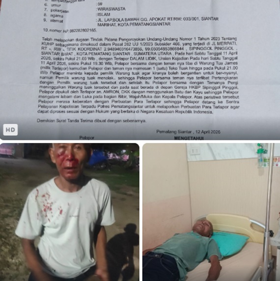 Warga Kota Pematangsiantar bernama Irwansyah Daulay (59), warga Lapangan Bola Bawah, Kecamatan Siantar Marihat,