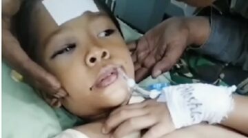 Seorang bocah 9 tahun diduga menjadi korban tabrak lari di Medan Tembung dan kini dirawat intensif di RS Haji Medan akibat luka serius.